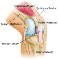 patellar tendonitis